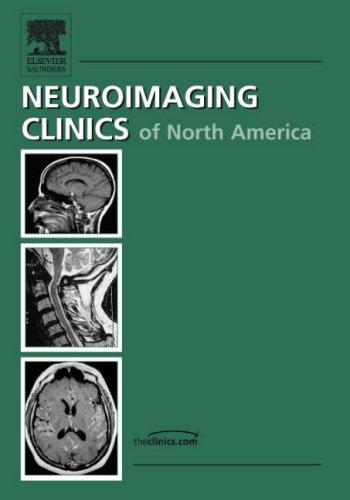 Spine Imaging, An Issue of Neuroimaging Clinics (The Clinics: Radiology)