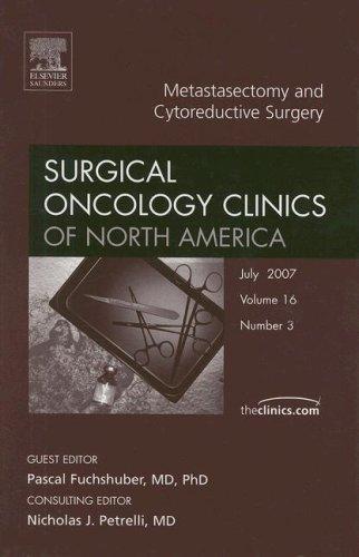 Metastectomy/Cytoreductive Surgery, An Issue of Surgical Oncology Clinics