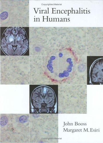 Viral encephalitis in humans