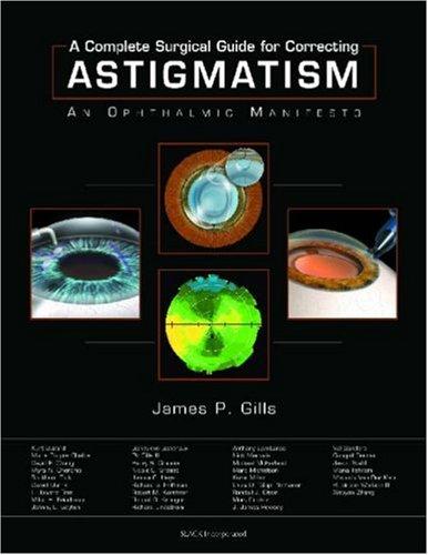 A Complete Surgical Guide for Correcting Astigmatism