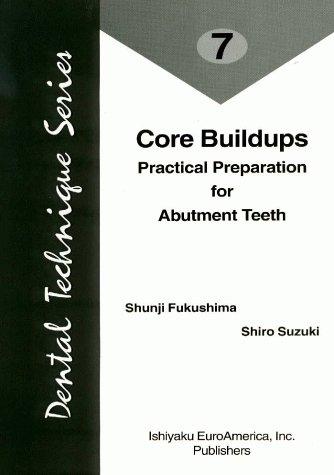 Core buildups