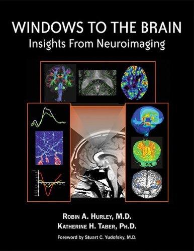 Windows to the brain