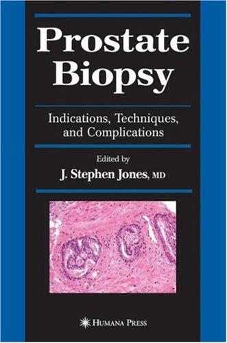 Prostate Biopsy