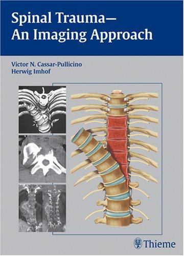 Spinal Trauma - An Imaging Approach