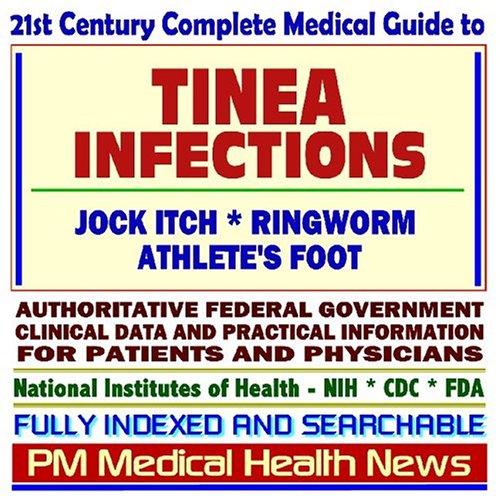 21st Century Complete Medical Guide to Tinea Infections, Jock Itch, Ringworm, and Athlete¿s Foot, Authoritative Government Documents, Clinical References, and Practical Information for Patients and Physicians