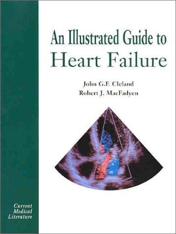 An Illustrated Guide to Heart Failure