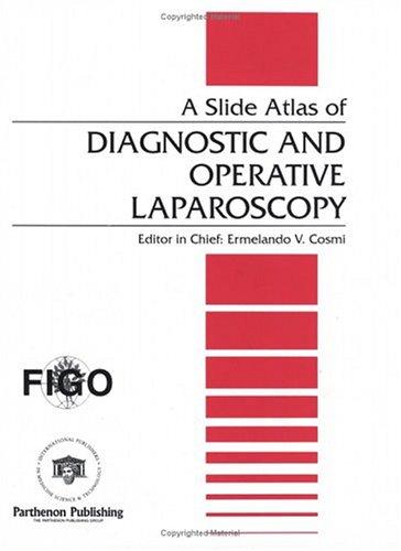A Slide Atlas of Diagnostic and Operative Laparoscopy