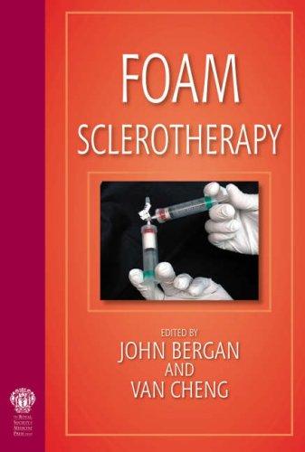 Foam Sclerotherapy