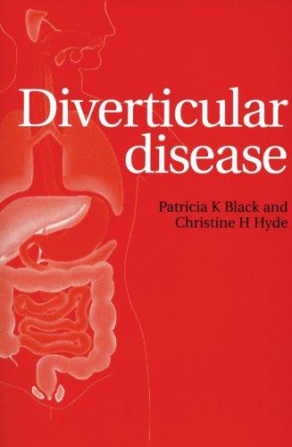 Diverticular disease
