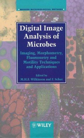 Digital image analysis of microbes
