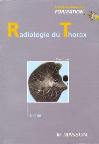 Thorax