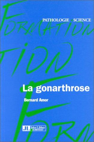 La gonarthrose