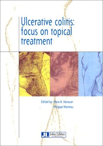 Ulcerative Colitis