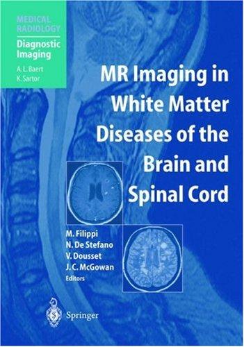 MR imaging in white matter diseases of the brain and spinal cord