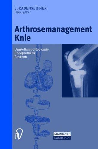 Arthrosemanagement Knie