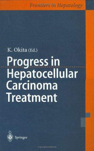 Progress in Hepatocellular Carcinoma Treatment