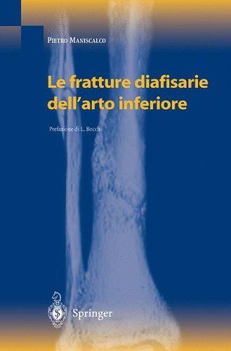 Le fratture diafisarie dell'arto inferiore