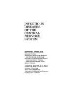 Infectious diseases of the central nervous system
