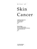 Atlas of skin cancer