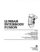 Lumbar interbody fusion