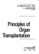 Principles of organ transplantation