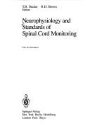 Neurophysiology and standards of spinal cord monitoring