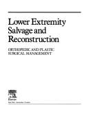 Lower extremity salvage and reconstruction