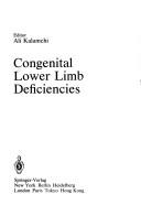 Congenital lower limb deficiencies
