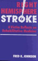Right hemisphere stroke