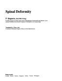 Spinal deformity