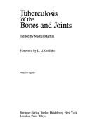 Tuberculosis of the bones and joints