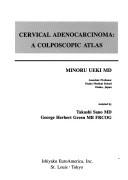 Cervical adenocarcinoma