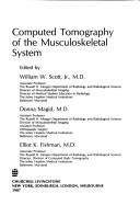 Computed tomography of the musculoskeletal system