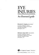Eye injuries
