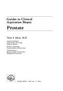 Prostate