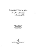 Computed tomography of CNS disease
