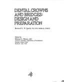 Dental Crowns and Bridges