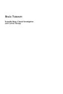Brain tumours