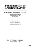 Fundamentals of angiography