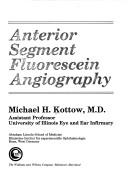 Anterior segment fluorescein angiography