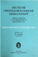Erkrankungen der Macula
