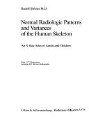 Normal radiologic patterns and variances of the human skeleton