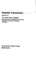 Platelet transfusion