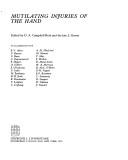 Mutilating injuries of the hand