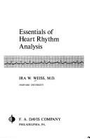 Essentials of heart rhythm analysis