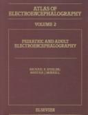 Neonatal electroencephalography