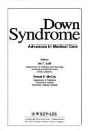 Down syndrome