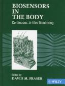 Biosensors in the Body