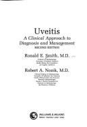 Uveitis