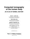 Computerized Tomography of the Human Body